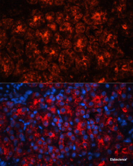 Immunohistochemistry of paraffin-embedded Rat brain using EIF4A2 Polyclonal Antibody at dilution of  1:100 (40x lens).