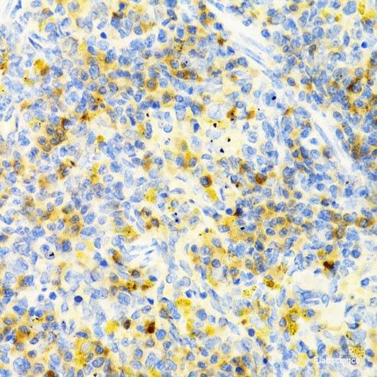 Immunofluorescence analysis of U2OS cells using PDK2 Polyclonal Antibody at dilution of  1:100. Blue: DAPI for nuclear staining.