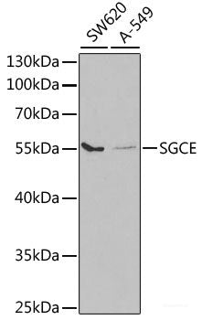 Immunohistochemistry of paraffin-embedded Rat liver using CBX6 Polyclonal Antibody at dilution of  1:100 (40x lens).