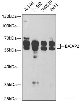 Immunohistochemistry of paraffin-embedded Human colon carcinoma using Snail Polyclonal Antibody at dilution of  1:100 (40x lens).