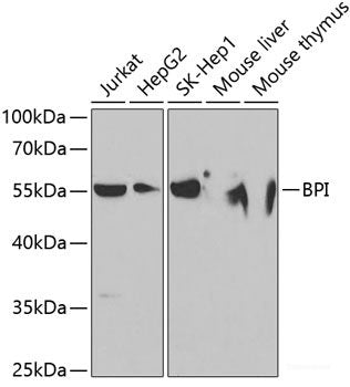 Western blot analysis of extracts of various cell lines using GNAS Polyclonal Antibody at dilution of 1:1000.