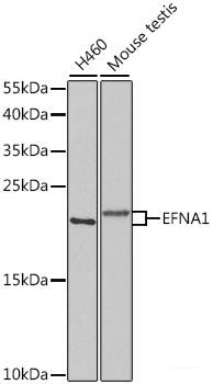 Immunofluorescence analysis of HeLa cells using NRF1 Polyclonal Antibody at dilution of  1:100. Blue: DAPI for nuclear staining.