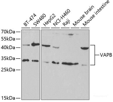 Immunofluorescence analysis of A549 cells using CDC5L Polyclonal Antibody