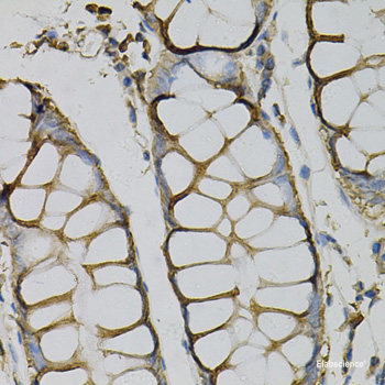 Immunohistochemistry of paraffin-embedded Rat kidney using SH2B1 Polyclonal Antibody at dilution of  1:100 (40x lens).