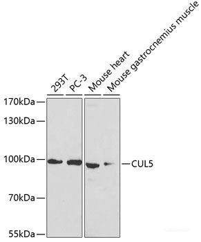 Immunohistochemistry of paraffin-embedded Human liver cancer using WNK3 Polyclonal Antibody at dilution of  1:100 (40x lens).
