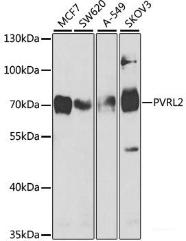 Immunohistochemistry of paraffin-embedded Human liver damage using FUBP1 Polyclonal Antibody at dilution of  1:100 (40x lens).