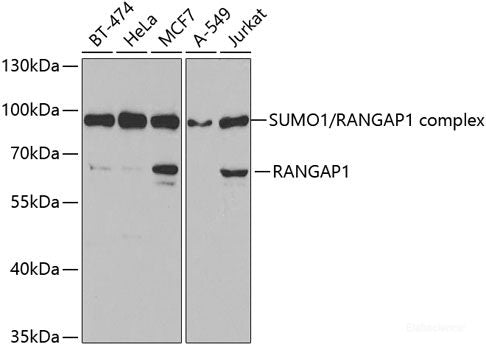 Immunofluorescence analysis of C6 cells using Acetyl-DNMT1-K1127/K1129/K1131/K1133 Polyclonal Antibody at dilution of  1:100. Blue: DAPI for nuclear staining.