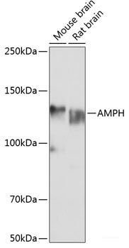 Immunohistochemistry of paraffin-embedded Rat testis using HPX Polyclonal Antibody at dilution of  1:100 (20x lens).