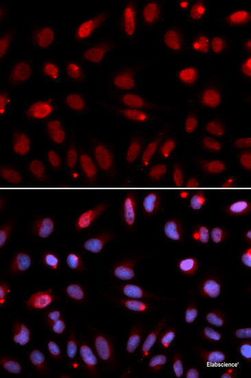Immunohistochemistry of paraffin-embedded Rat kidney using PGRMC1 Polyclonal Antibody at dilution of  1:100 (40x lens).