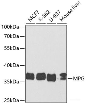 Immunofluorescence analysis of Human placenta using CFI Polyclonal Antibody at dilution of  1:100. Blue: DAPI for nuclear staining.
