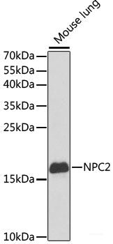 Immunohistochemistry of paraffin-embedded Human prostate using GNRH1 Polyclonal Antibody at dilution of  1:100 (40x lens).