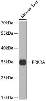 Immunohistochemistry of paraffin-embedded Human lung using APOC1 Polyclonal Antibody at dilution of  1:100 (40x lens).