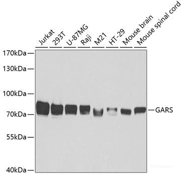Immunofluorescence analysis of NIH/3T3 cells using FGG Polyclonal Antibody at dilution of  1:100. Blue: DAPI for nuclear staining.