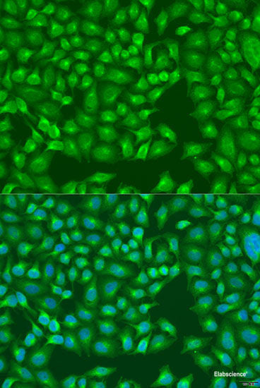 Immunohistochemistry of paraffin-embedded Human liver damage using IL4 Polyclonal Antibody at dilution of  1:100 (40x lens).