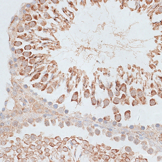 Immunohistochemistry of paraffin-embedded Rat brain using TNFSF12 Polyclonal Antibody at dilution of  1:100 (20x lens).