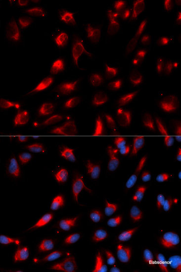 Immunohistochemistry of paraffin-embedded Rat kidney using KITLG Polyclonal Antibody at dilution of  1:200 (40x lens).