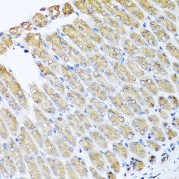 Immunohistochemistry of paraffin-embedded Rat brain using RBPJ Polyclonal Antibody at dilution of  1:100 (40x lens).
