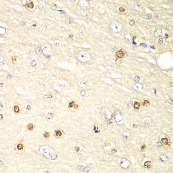 Immunohistochemistry of paraffin-embedded Human placenta using IQGAP1 Polyclonal Antibody at dilution of  1:200 (40x lens).