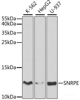 Immunohistochemistry of paraffin-embedded Rat brain using TP53BP2 Polyclonal Antibody at dilution of  1:100 (40x lens).