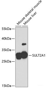 Immunohistochemistry of paraffin-embedded Rat brain using ZEB2 Polyclonal Antibody at dilution of  1:100 (40x lens).