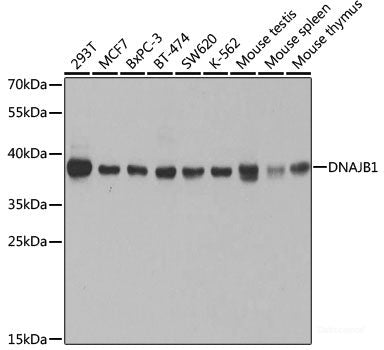 Immunohistochemistry of paraffin-embedded Human stomach using RUVBL1 Polyclonal Antibody at dilution of  1:100 (40x lens).