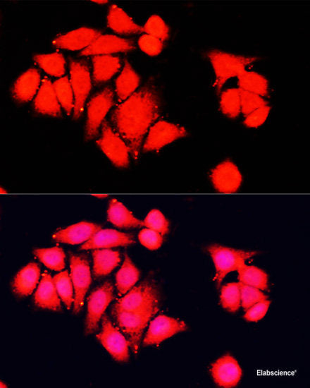 Immunohistochemistry of paraffin-embedded Human spleen using CD14 Polyclonal Antibody at dilution of  1:100 (40x lens).