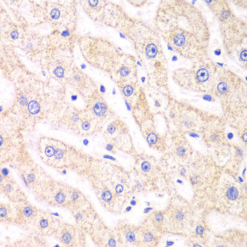 Immunohistochemistry of paraffin-embedded Human stomach using ST6GAL1 Polyclonal Antibody at dilution of  1:100 (40x lens).