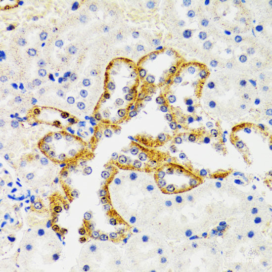 Immunohistochemistry of paraffin-embedded Rat ovary using p53 Polyclonal Antibody at dilution of  1:100 (40x lens).