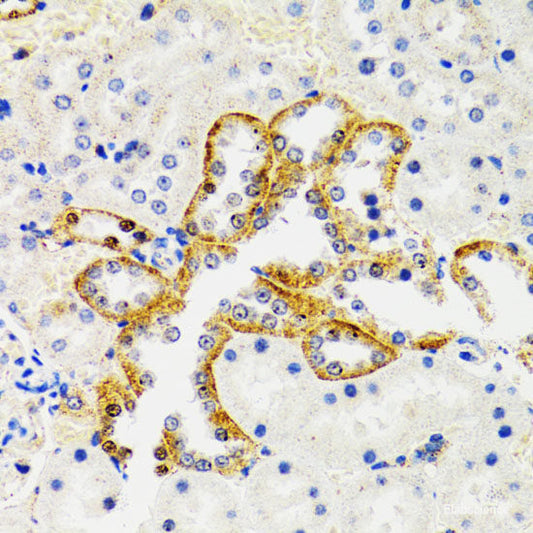 Immunohistochemistry of paraffin-embedded Rat ovary using p53 Polyclonal Antibody at dilution of  1:100 (40x lens).