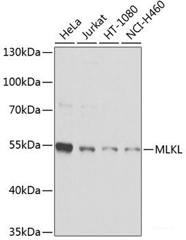 Immunohistochemistry of paraffin-embedded Rat brain using HEXIM1 Polyclonal Antibody at dilution of  1:100 (40x lens).