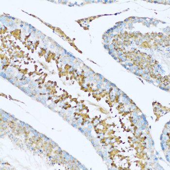 Immunohistochemistry of paraffin-embedded Human stomach using BAG5 Polyclonal Antibody at dilution of  1:100 (40x lens).