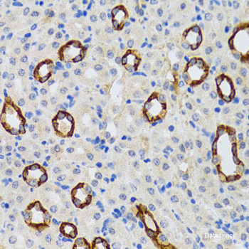 Immunohistochemistry of paraffin-embedded Rat lung using DEDD Polyclonal Antibody at dilution of  1:100 (40x lens).