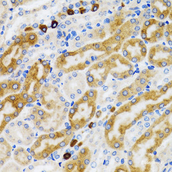 Immunohistochemistry of paraffin-embedded Mouse lung using ATG3 Polyclonal Antibody at dilution of  1:200 (40x lens).