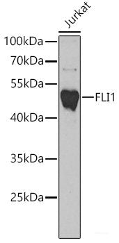 Immunohistochemistry of paraffin-embedded Human liver damage using PRODH Polyclonal Antibody at dilution of  1:100 (40x lens).