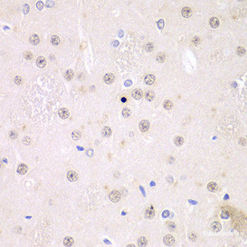 Immunohistochemistry of paraffin-embedded Mouse lung using RHOT1 Polyclonal Antibody at dilution of  1:100 (40x lens).