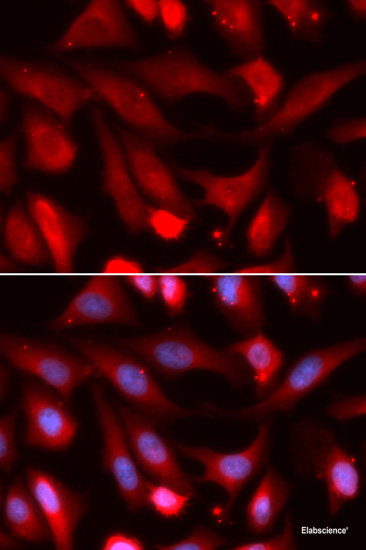 Immunofluorescence analysis of A431 cells using PRKCB Polyclonal Antibody at dilution of  1:100. Blue: DAPI for nuclear staining.
