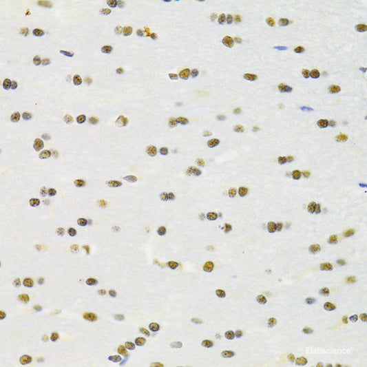 Western blot analysis of extracts of SKOV3 cells using WNT2 Polyclonal Antibody at dilution of 1:1000.