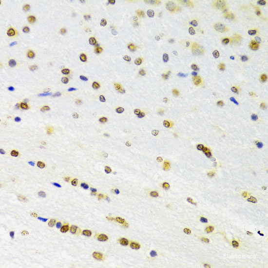 Immunohistochemistry of paraffin-embedded Rat heart using HNRNPR Polyclonal Antibody at dilution of  1:100 (40x lens).
