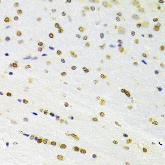 Immunohistochemistry of paraffin-embedded Rat heart using HNRNPR Polyclonal Antibody at dilution of  1:100 (40x lens).