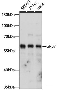 Immunohistochemistry of paraffin-embedded Rat brain using MTDH Polyclonal Antibody at dilution of  1:200 (40x lens).