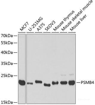 Western blot analysis of extracts of Mouse brain using AATF Polyclonal Antibody.