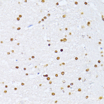 Immunohistochemistry of paraffin-embedded Human gastric using NCL Polyclonal Antibody at dilution of  1:200 (40x lens).