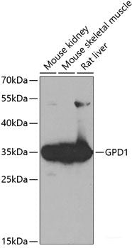 Western blot analysis of extracts of various cell lines using ELAVL2 Polyclonal Antibody at dilution of 1:1000.