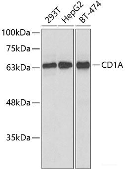 Immunohistochemistry of paraffin-embedded Rat liver using POLR2B Polyclonal Antibody at dilution of  1:100 (40x lens).