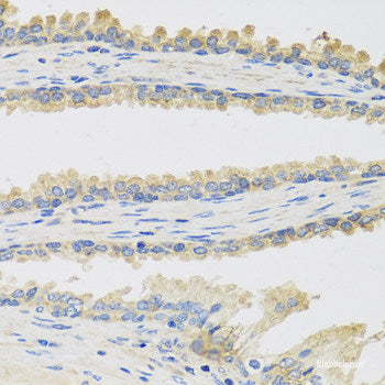 Immunofluorescence analysis of L-929 cells using EIF3D Polyclonal Antibody at dilution of  1:100. Blue: DAPI for nuclear staining.