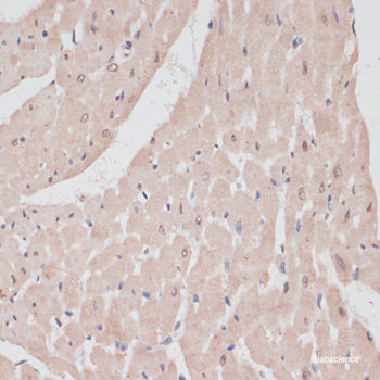 Immunohistochemistry of paraffin-embedded Mouse brain using UTP14A Polyclonal Antibody at dilution of  1:100 (40x lens).