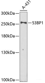 Immunohistochemistry of paraffin-embedded Rat liver using HDLBP Polyclonal Antibody at dilution of  1:100 (40x lens).