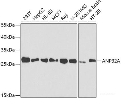 Immunohistochemistry of paraffin-embedded Rat brain using RPS10 Polyclonal Antibody at dilution of  1:100 (40x lens).