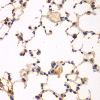Immunofluorescence analysis of U2OS cells using SFRS9 Polyclonal Antibody at dilution of  1:100. Blue: DAPI for nuclear staining.