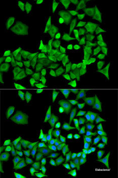 Immunohistochemistry of paraffin-embedded Rat testis using IGF2BP3 Polyclonal Antibody at dilution of  1:100 (40x lens).